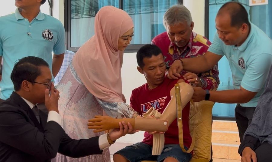 Lisda Hendrajoni Fasilitasi Pemasangan Kaki dan Tangan Palsu untuk 52 Disabilitas